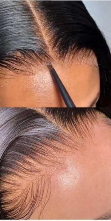 Close-up of hairline with a hairbrush and comparison of hair density.