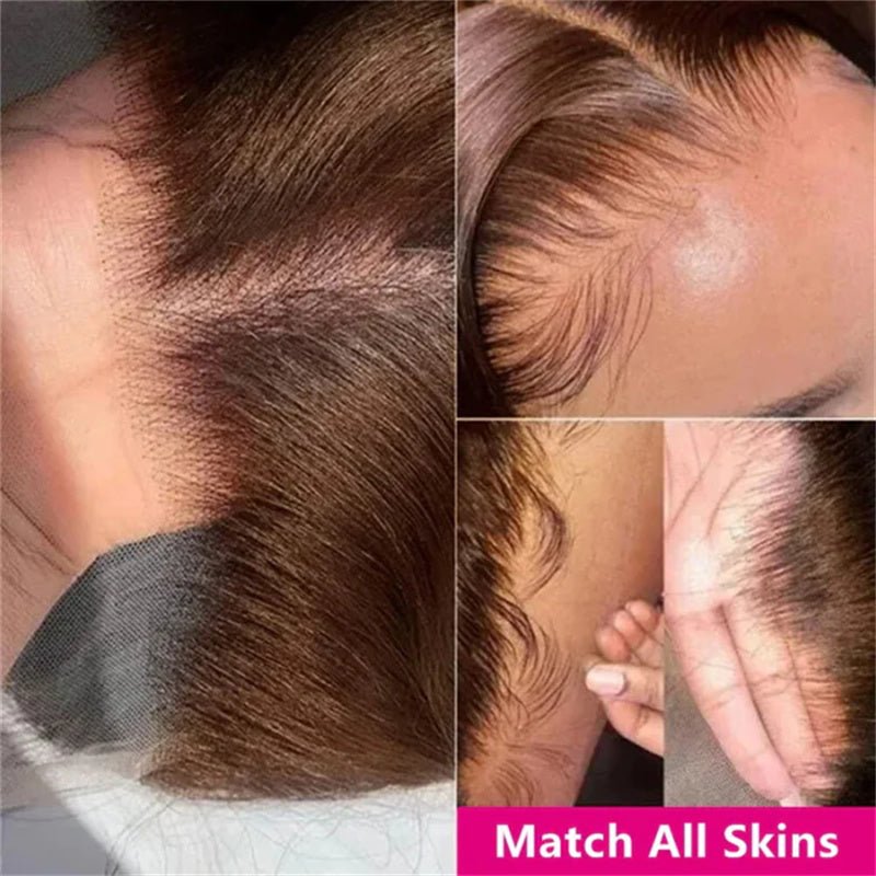 Close-up of hairline with text 'Match All Skins' on a pink banner.